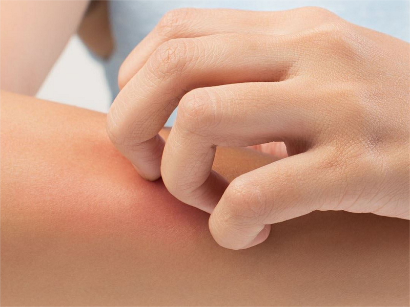 Sensitive skin fabric